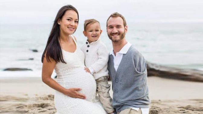 O Bir Azim Ve Başarı Hikayesi: Eksiklerini Kalbiyle Tamamlayan Uzuvsuz Adam Nick Vujicic