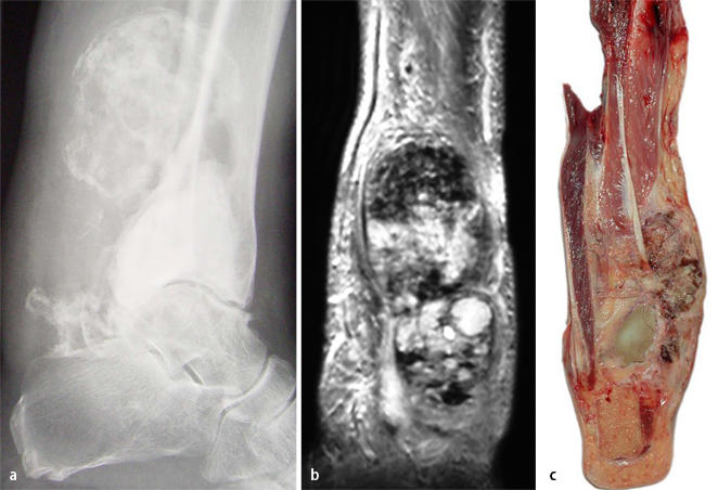 Bir Yavrunun Hayatını Söndüren Kemik Hastalığı: Osteosarkom!