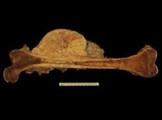 Bir Yavrunun Hayatını Söndüren Kemik Hastalığı: Osteosarkom!