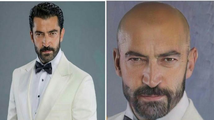 Kadınların Beğendiği Kel Ünlülerin Ya Sırma Saçları Olsaydı, Yine Beğenirler miydi?