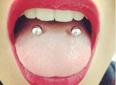 Derin Bir İkilem: Dil Piercing'i ve Diş Sağlığı