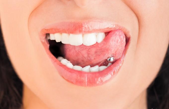 Derin Bir İkilem: Dil Piercing'i ve Diş Sağlığı