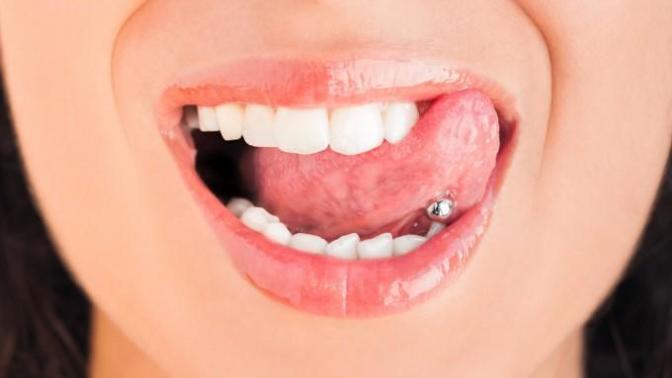 Derin Bir İkilem: Dil Piercing'i ve Diş Sağlığı