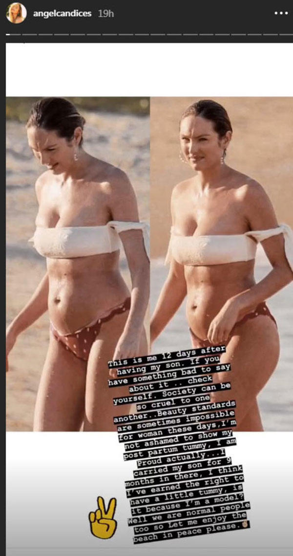 Sosyal Zorbalık Sınır Tanımıyor: Taze Anne Candice Swanepoel Doğum Sonrası Kiloları ile Eleştirilerin Hedefi Oldu!
