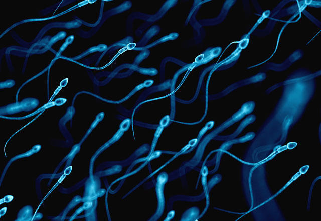 Sperm Kalitesini Azaltan Faktörler Nelerdir?