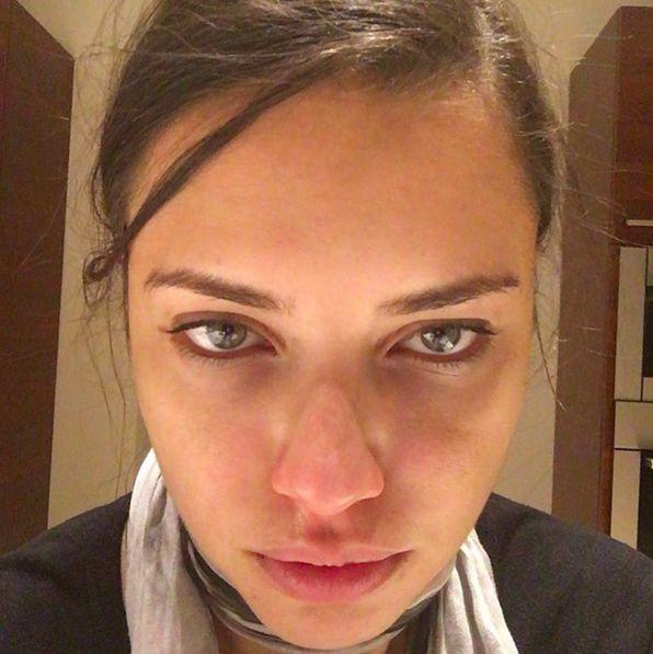 Ünlülerin “Bunu Kendine Neden Yaptın?” Diye Sorgulatıp Göz Kanatan Fotoğrafları