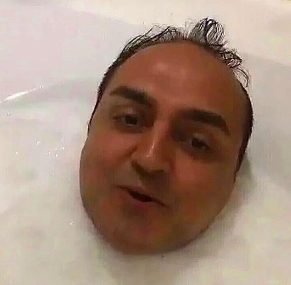 Ünlülerin “Bunu Kendine Neden Yaptın?” Diye Sorgulatıp Göz Kanatan Fotoğrafları
