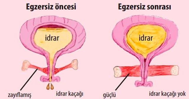 Cinsel Yaşamınızın Altın Çağını Başlatacak Egzersizler: Kegel Egzersizleri Nedir?