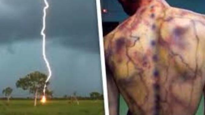 Yıldırımın Çarptığı İnsanlara Bıraktığı İzler: Lichtenberg Figürleri!