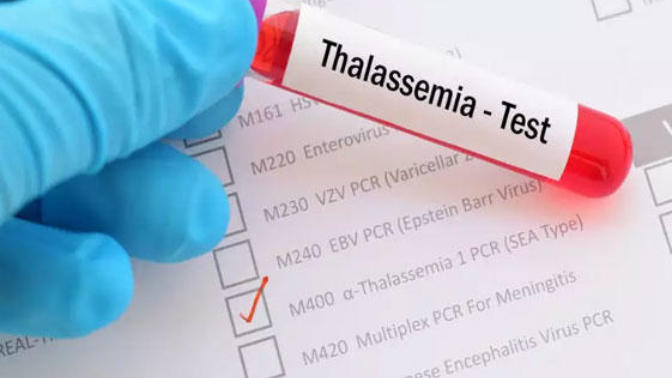 Talasemi Taşıyıcılığı Nedir?