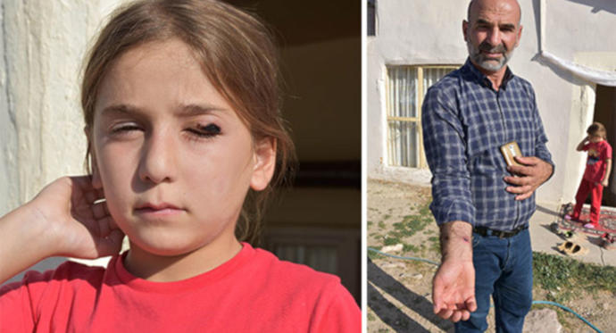 Gündeme Bomba Gibi Düşen Salgın: Şarbon!