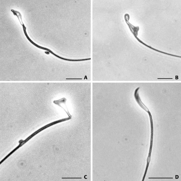 Kamikaze Sperm Örnekleri
