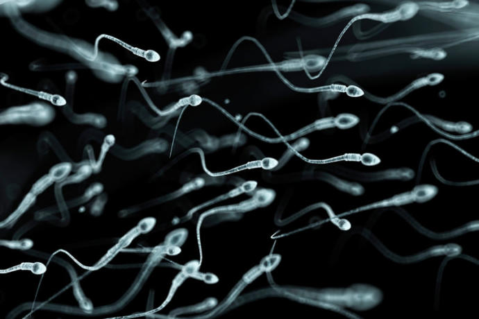 Sperm