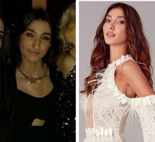 Miss Turkey 2018 Birincisi Estetik Güzeli Çıkınca Ortalık Karıştı