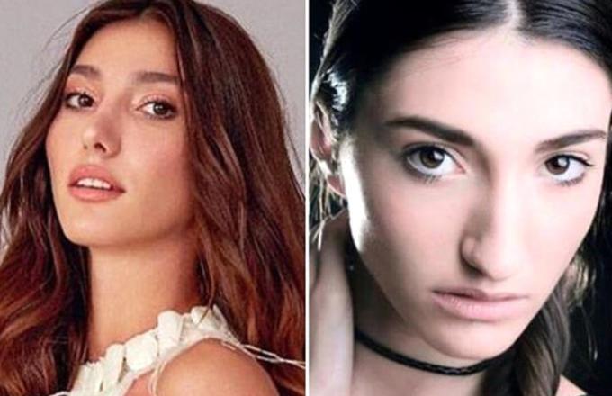 Miss Turkey 2018 Birincisi Estetik Güzeli Çıkınca Ortalık Karıştı