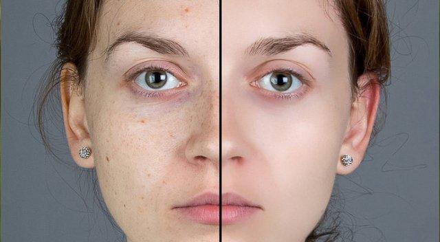 Vücudumda A Vitamini Eksik Olduğunu Nasıl Anlarım?