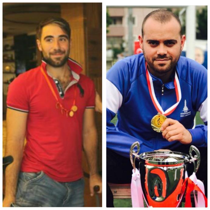 Meksika Yolcusu Kalmasın: Dünya Şampiyonu Adayı Ampute Milli Takım Futbolcuları KizlarSoruyorda!