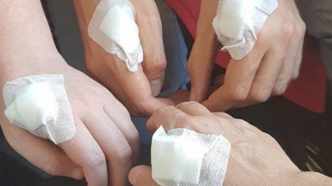 "Oha İnanmıyorum Ya" Dedirten, Dünyanın En İlginç Trendi: Elin İçine Çip Taktırmak!