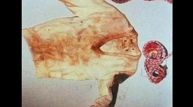 Kötülüğe İyilikle Karşılık Vermenin, Bir İnsanı Hayata Nasıl Bağladığını Gösteren Trajedik Bir Hikaye