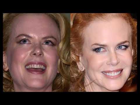 Nicol Kidman'ın gülümsemesi
