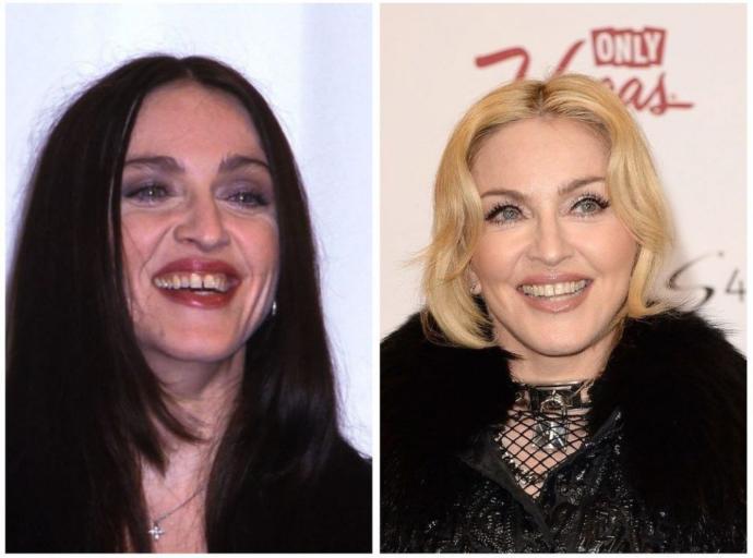 Madonna'nın gülümsemesi