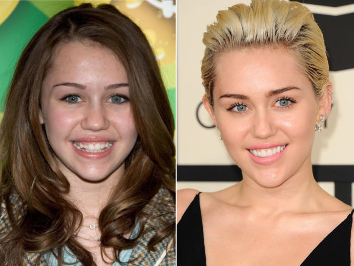 Miley Cyrus'un gülümsemesi