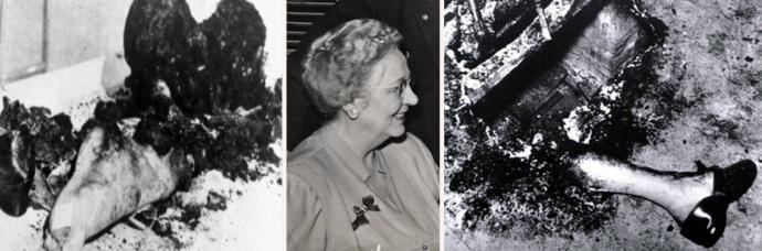 Spontaneous Human Combustion (SCH): Kendi Kendine Yanan İnsanların Korkutan Gizemi