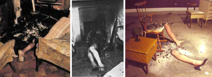 Spontaneous Human Combustion (SCH): Kendi Kendine Yanan İnsanların Korkutan Gizemi