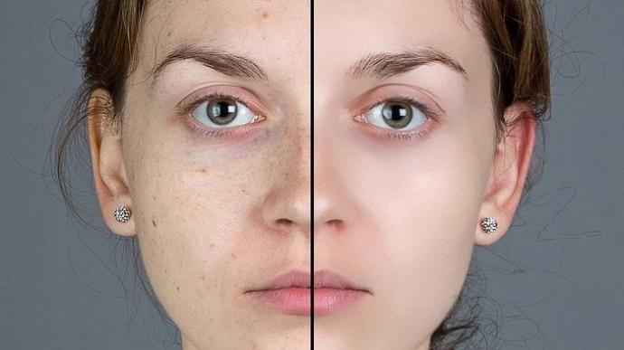 Limonlu Su İçtiğinizde Vücudunuzda Oluşan Değişimler Nelerdir?