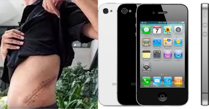iPhone Satın Almak İçin Böbreklerini Satan Genç Diyalize Girmeye Başladı