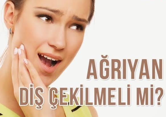 Diş kaybı