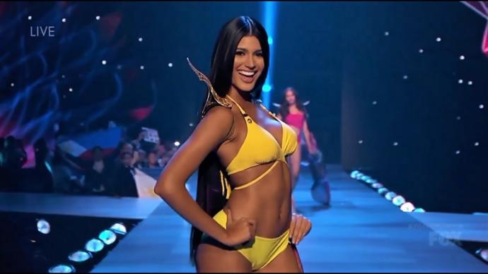 Venezuela Güzeli Estetik Yaptırmış