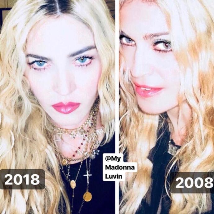 Madonna