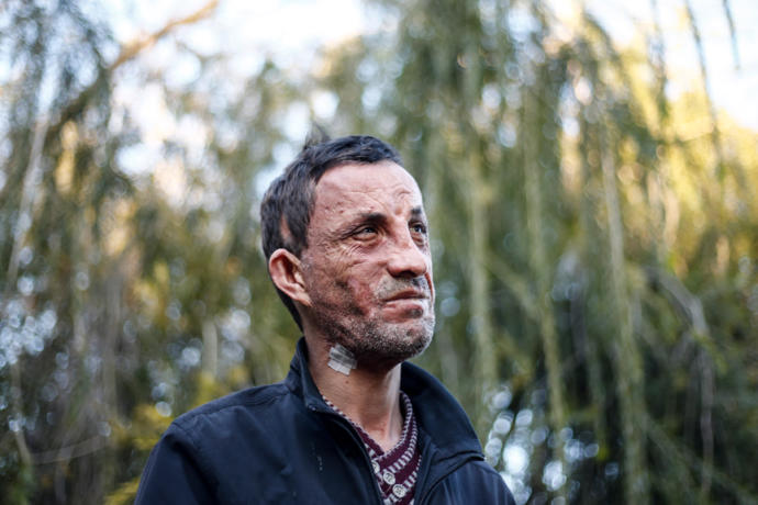 Yeni Bir Yüz Yeni Bir Hayat