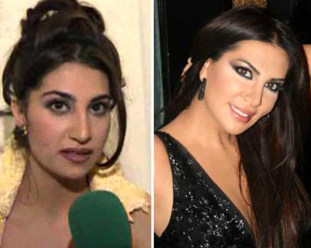 Estetiksiz Hallerini Görünce Yapanın Ellerine Sağlık Diyeceğimiz Ünlüler