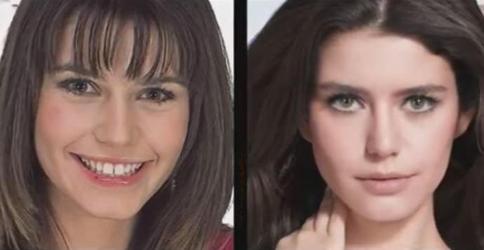 Diş Estetiğinde Kendine Yeni Bir Ağız Satın Almış 5 Ünlü Kadın!