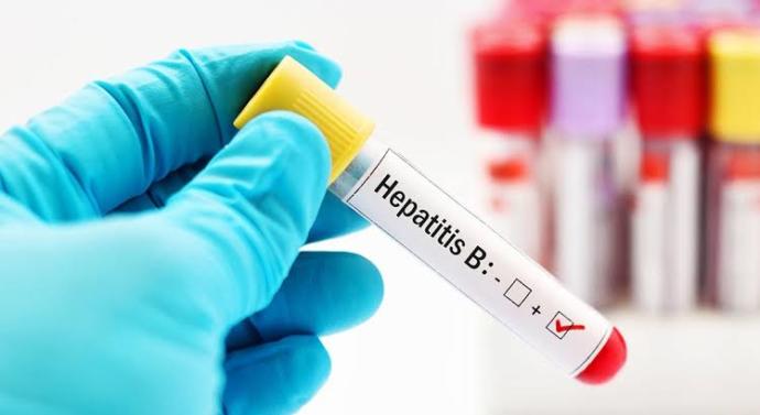 Hepatit b