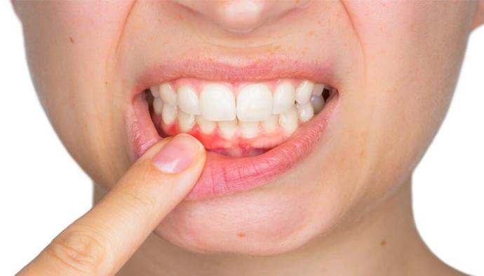 Hangi Vitaminim Eksik Bilmiyorum! Ayırt Edici Belirtilerle Hangi Vitamin Eksikliğimiz Var?