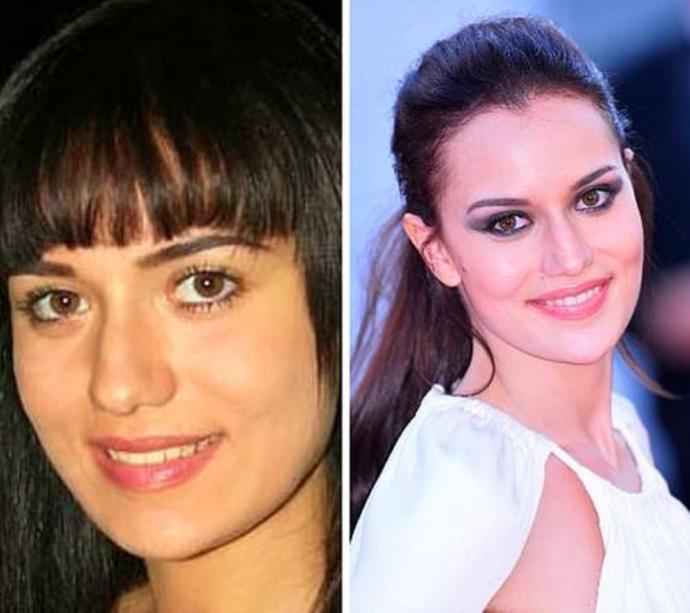 Görünce '’Yok Artık”' Diyeceğiniz 10 Ünlü İsmin Estetiksiz Halleri!