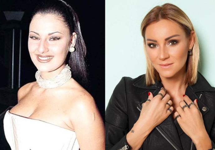 Görünce '’Yok Artık”' Diyeceğiniz 10 Ünlü İsmin Estetiksiz Halleri!