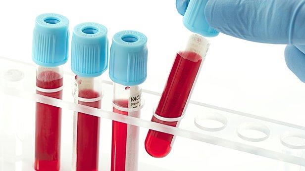 Doğum Sırasında Bebeğinin Kordon Kanını Saklamak İçin 5 Mükemmel Neden!
