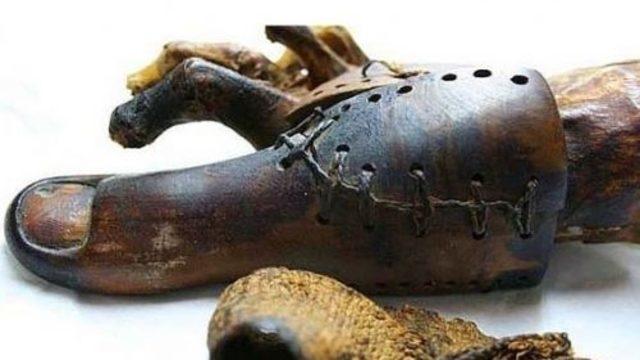 Geçmişte Kullanılan Ürkütücü Tıbbi Aletler ve Yöntemler!
