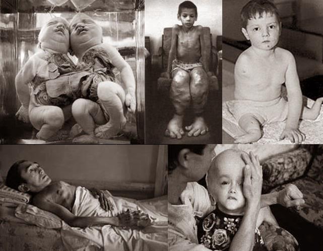 Çernobil Faciası ve Hayalet Şehir: Pripyat