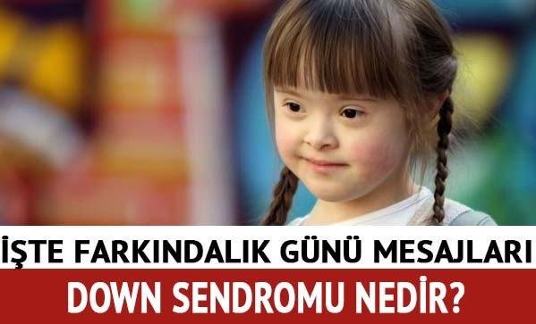 Down sendromu fazlalıktır.