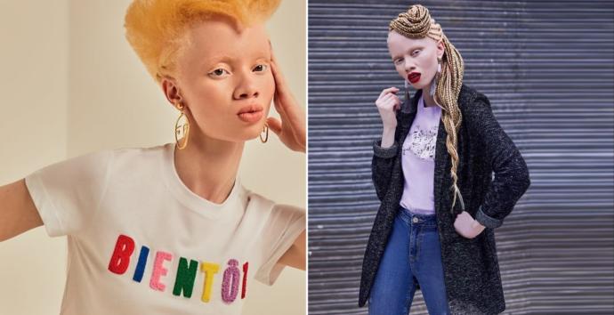 Sıra Dışı Görüntüleriyle Moda Dünyasına Damga Vuran 6 Kadın!