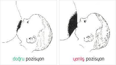 Yeni Annelerin Yaşadığı İçini Sızım Sızım Sızlatan Dert: Göğüs Ucu Acısı Nasıl Geçer?