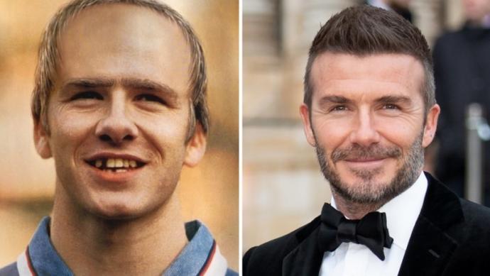Erkekler De Bakım Yapar: 4 Hamlede David Beckham Gibi Olmak!