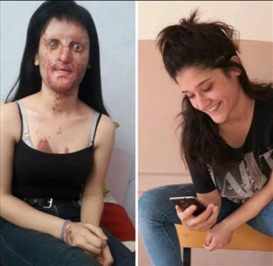 Özgecan Aslan'ı Unuttuk mu? 4 Yıl Önce Kaybettiğimiz Meleğimiz!