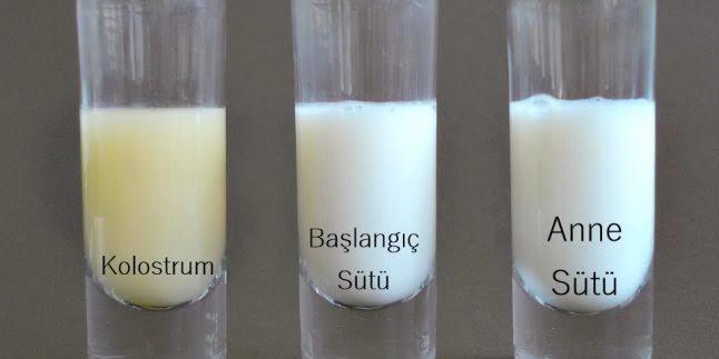 Anne Sütünün Farklı Renk Gelmesi