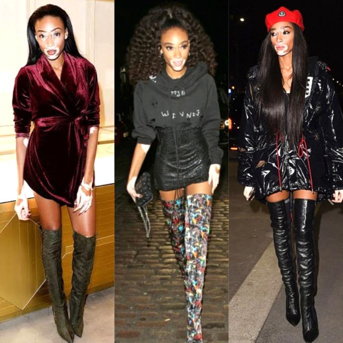 Winnie Harlow